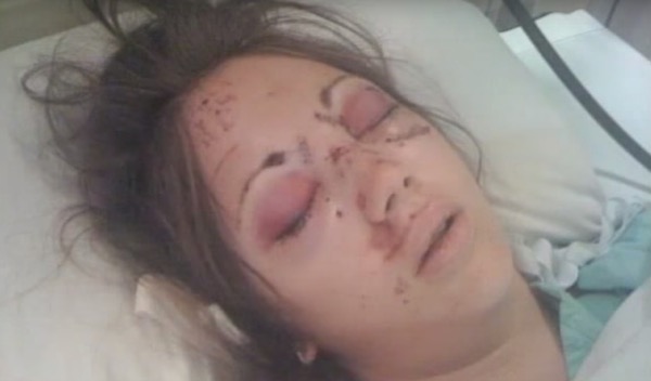 1659738147-3974-accident-dash-1